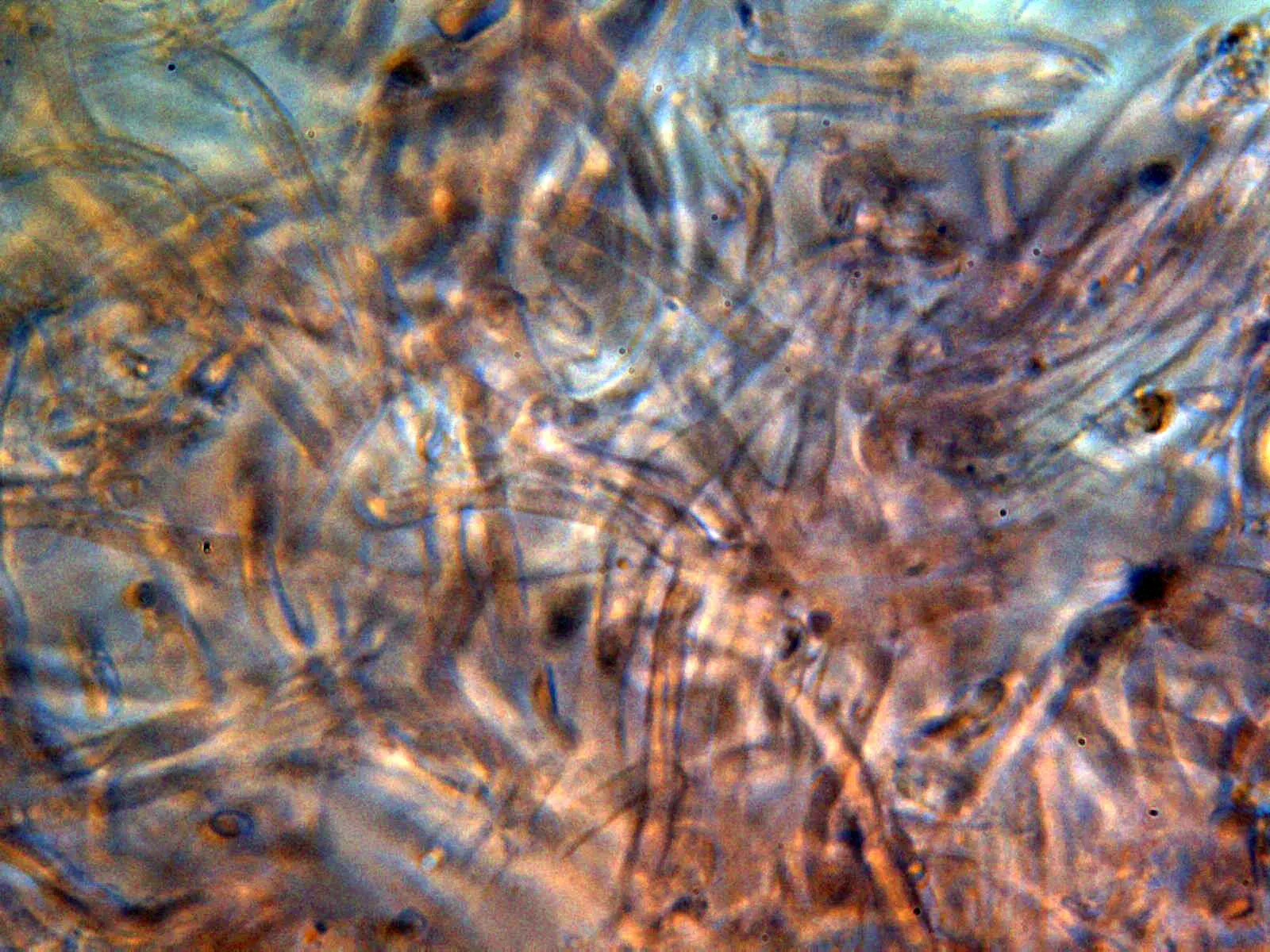 Microscopía de Russula delica - 13 - Suprapellis
